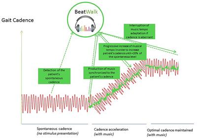 BeatWalk: Personalized Music-Based Gait Rehabilitation in Parkinson’s Disease
